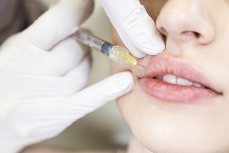 best lip fillers candidates