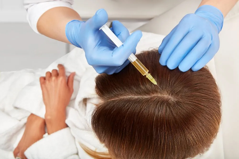 PRP Hair Restoration Before and After