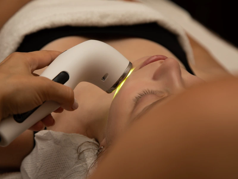 acne treatment in frisco tx