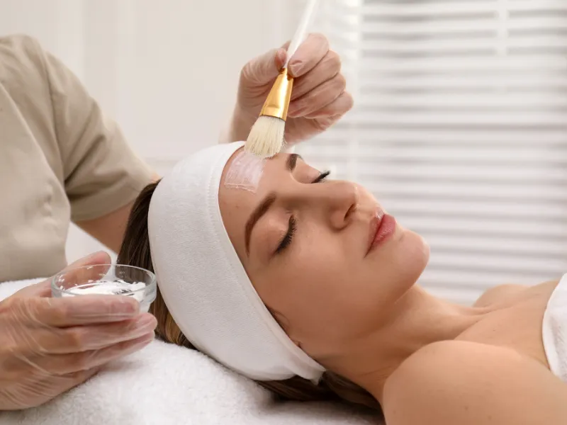 chemical peel for hyperpigmentation treatment candidates