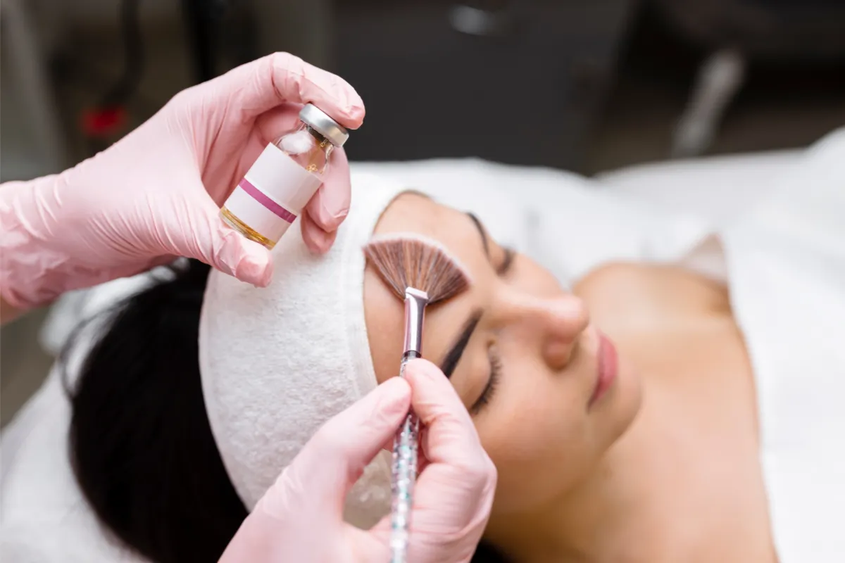 chemical peel for hyperpigmentation treatement