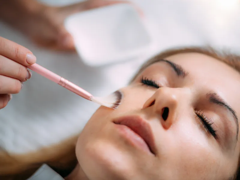 chemical peel for hyperpigmentation treatment benefits