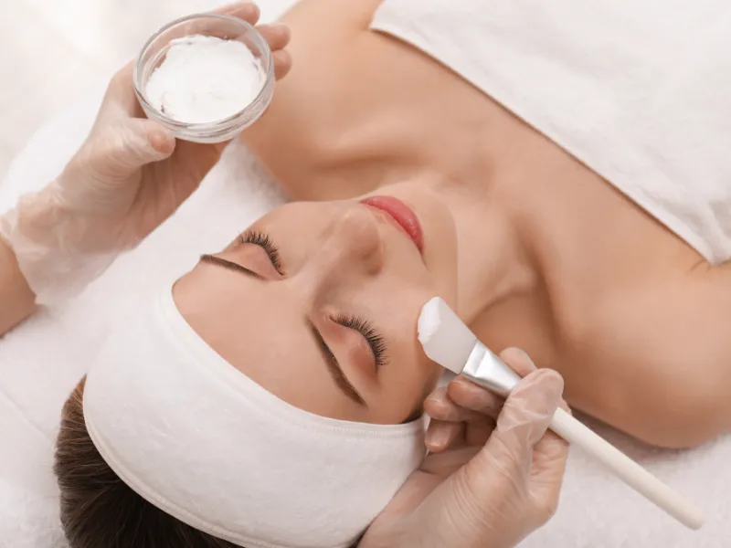 chemical peel for hyperpigmentation treatment process