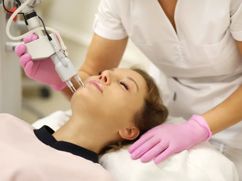 hyperpigmentation laser treatment