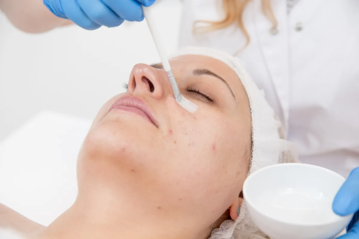hyperpigmentation treatment