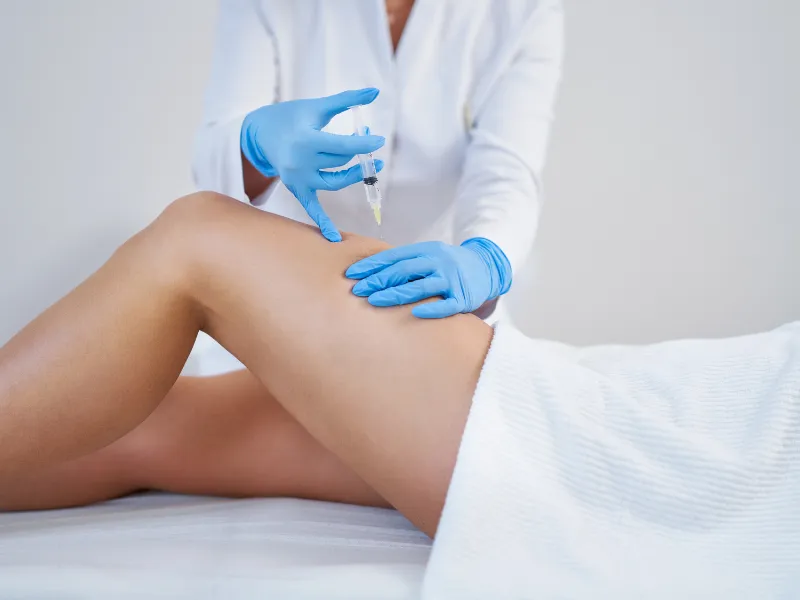 spider veins treatment procedure