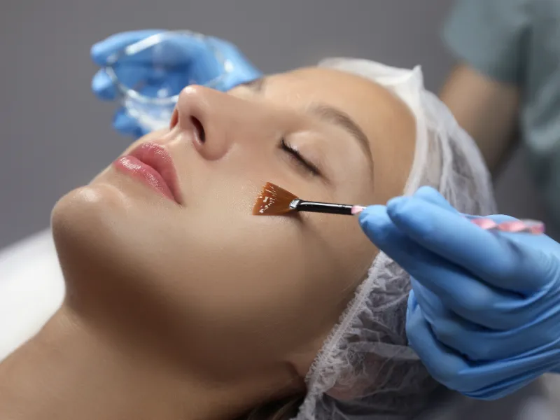sun spot removal process