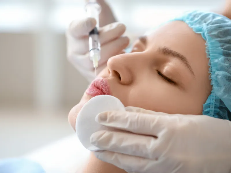 target areas for juvederm and restylane