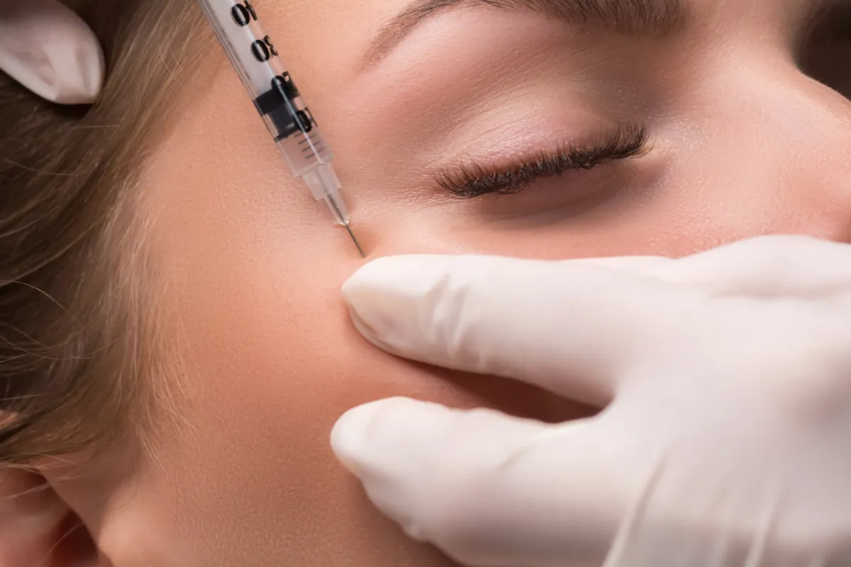 dermal fillers for under eyes