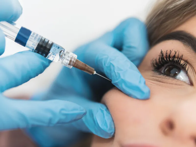 jowl filler treatment