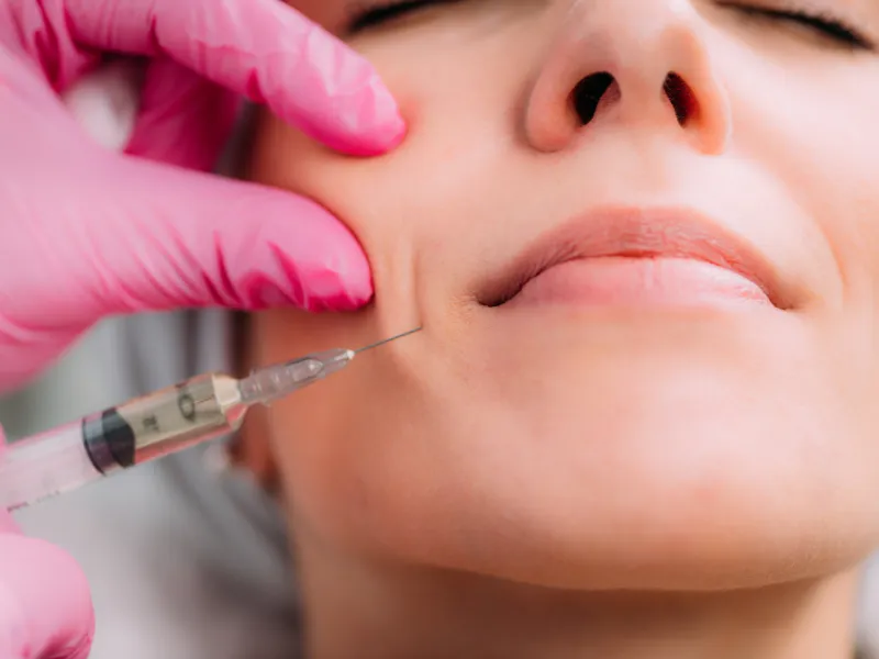 role of dermal fillers